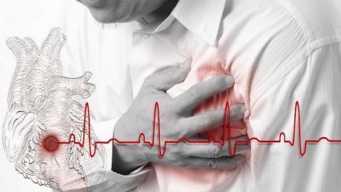 الاضطرابات العقلية واحتمالات الإصابة بالنوبات القلبية والسكتات الدماغية