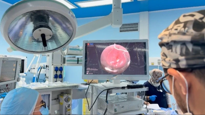 الوادي.. إجراء عمليات متخصصة في جراحة الأنف والأذن والحنجرة
