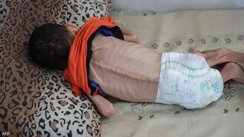 الإعلام الحكومي: قطاع غزة على أعتاب مقتلة جماعية مرتقبة بحق 100 ألف طفل خلال أيام