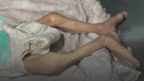 ارتفاع شهداء المجاعة في غزة.. وعرقلة صهيونية مستمرة لدخول المساعدات